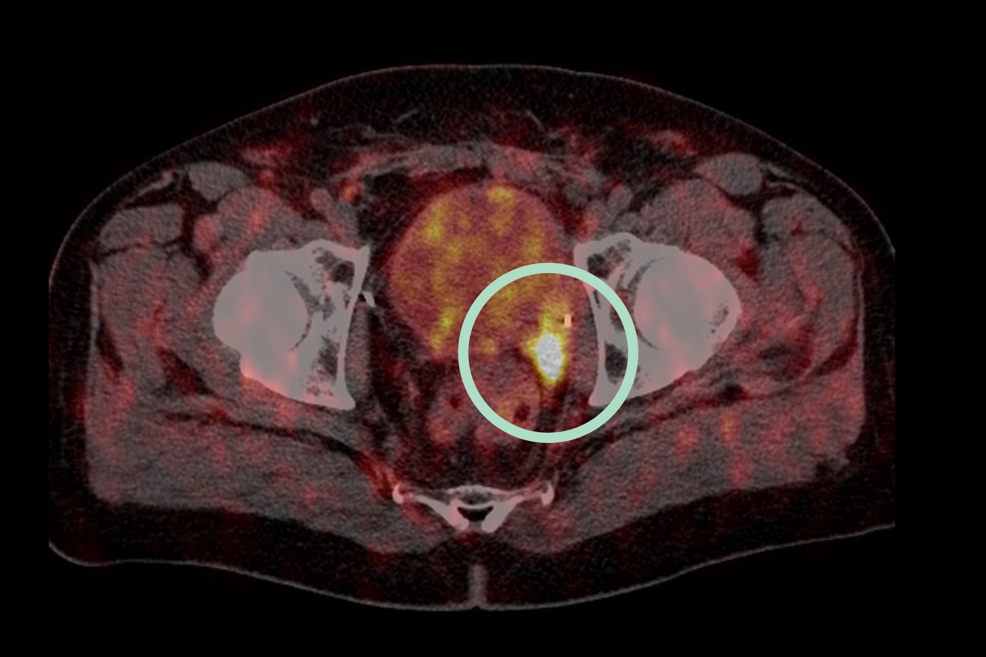 Ultraschalluntersuchungen, CT (Computertomographie) | Interventionelle Radiologie | Praxis für Radiologie & Nuklearmedizin
